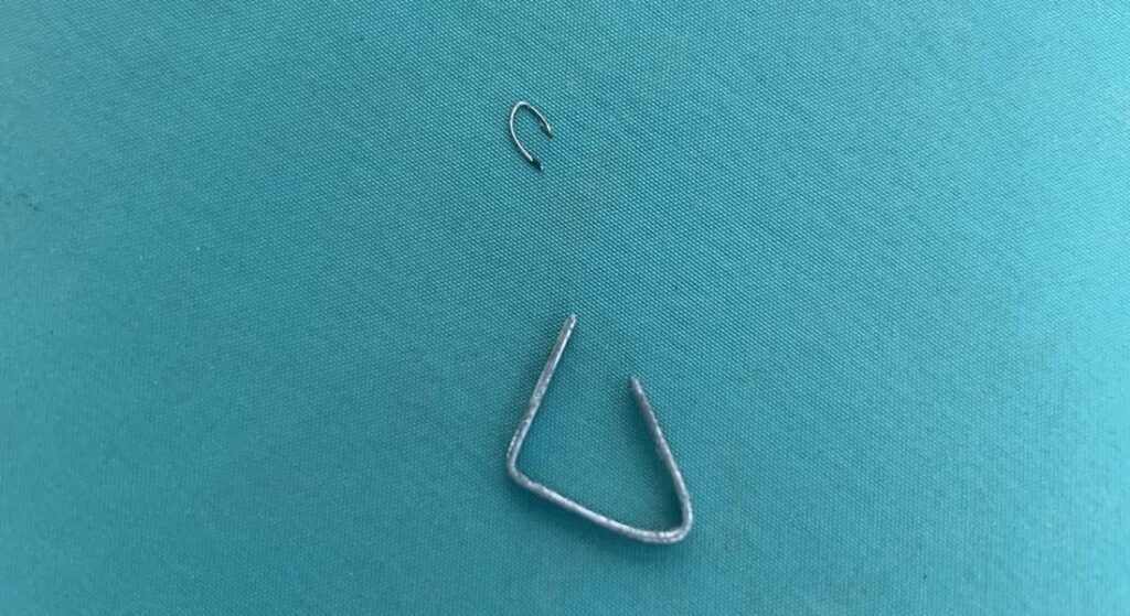 Staples removed from tire